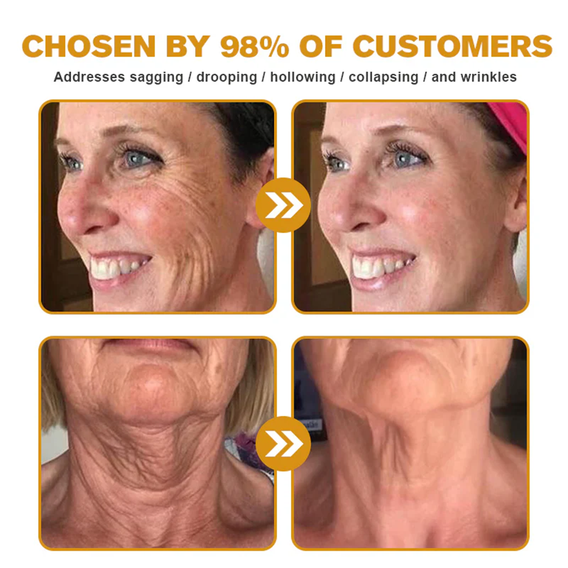 ✨FDA Approved:LOVILDS™Bee Toxin Skin Restoration Cream — 🔥Limited Time 70% OFF🔥