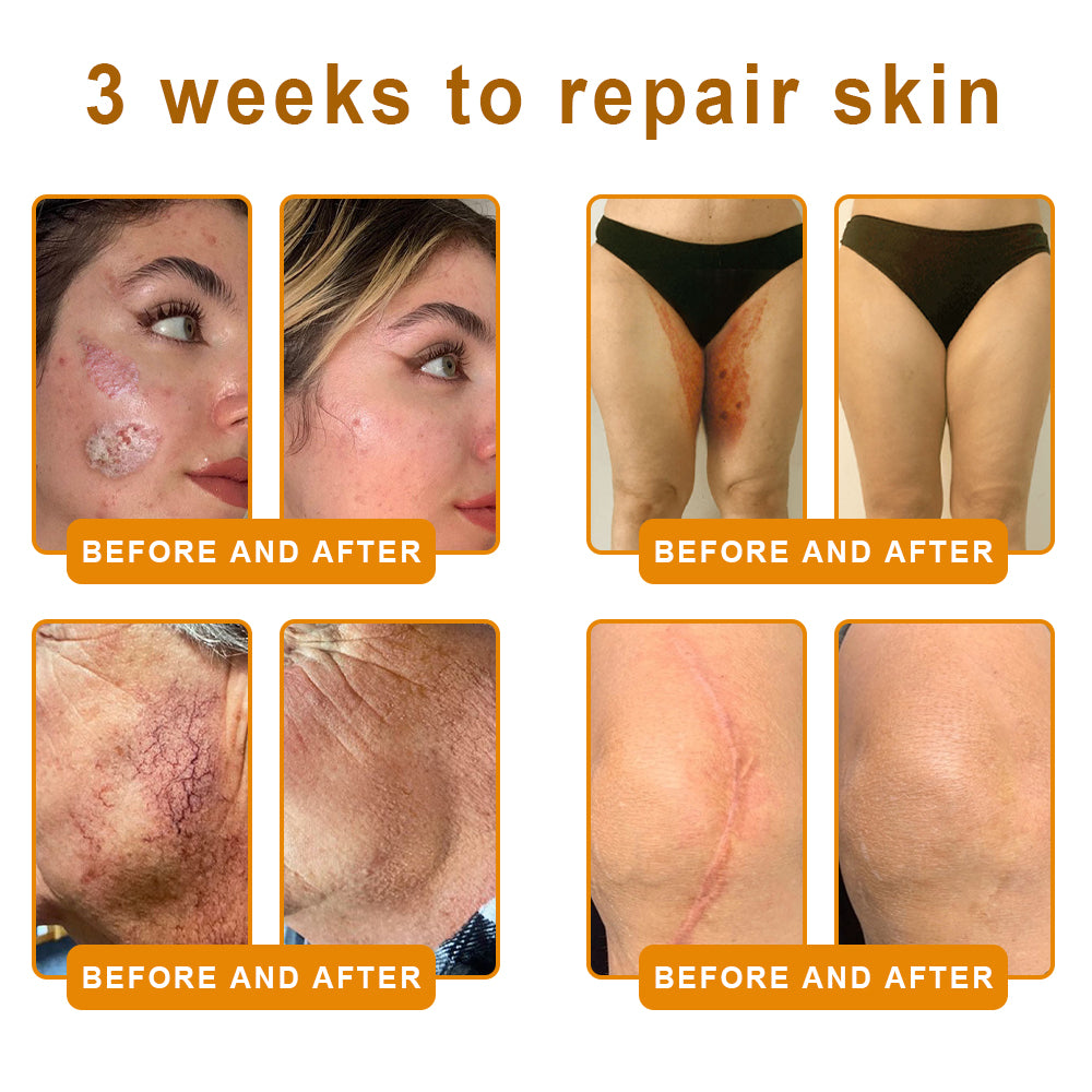 ✨FDA Approved:LOVILDS™Bee Toxin Skin Restoration Cream — 🔥Limited Time 70% OFF🔥