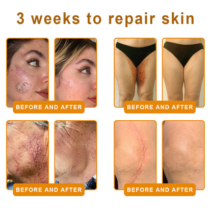 ✨FDA Approved:LOVILDS™Bee Toxin Skin Restoration Cream — 🔥Limited Time 70% OFF🔥