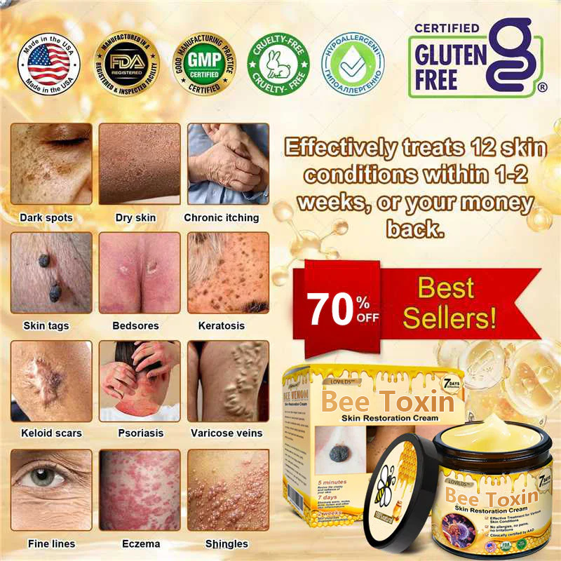 ✨FDA Approved:LOVILDS™Bee Toxin Skin Restoration Cream — 🔥Limited Time 70% OFF🔥